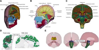 Development and Validation of a New Anisotropic Visco-Hyperelastic Human Head Finite Element Model Capable of Predicting Multiple Brain Injuries